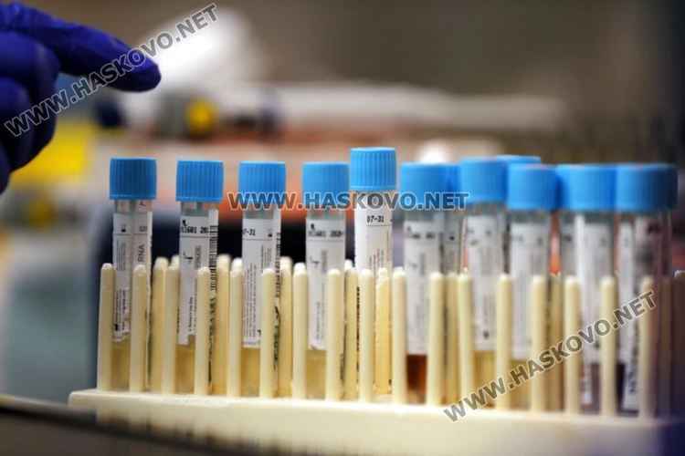 Шестима нови с Ковид 19 в областта, в Хасково няма нов случай